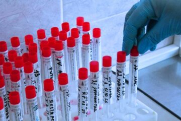 Тест на коронавирус. Фото: Baltnews