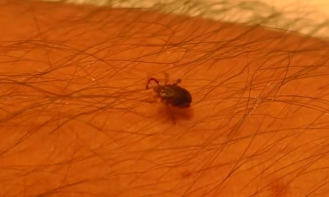 Клещ на коже. Фото: скрин youtube