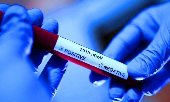 Тест на коронавирус. Фото: 5 канал