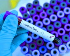 Тест-системы на коронавирус, фото: 112 Украина
