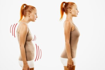 Топ-6 эффективных упражнений для лечения сутулости