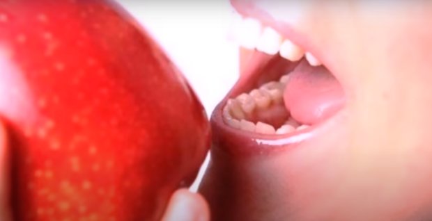 Как сохранить зубы здоровыми. Фото: скриншот YouTube