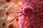 Американские ученые считают, что полностью от рака излечиться невозможно