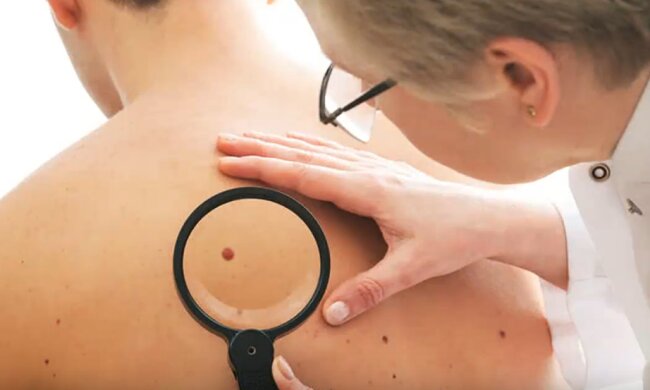 Любые изменения образований служат поводом для обследования. Фото: youtube