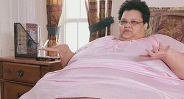 Фото не для слабонервных: 340 килограммовая женщина показала как худела