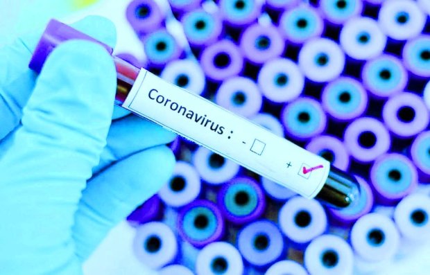 Тест на коронавирус. Фото: 112 Украина