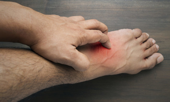 Названы виды кожной сыпи, которые могут означать раковые заболевания