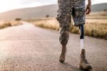 На Житомирщині за підтримки Естонії планують створити Центр реабілітації та протезування, – нардеп Пушкаренко
