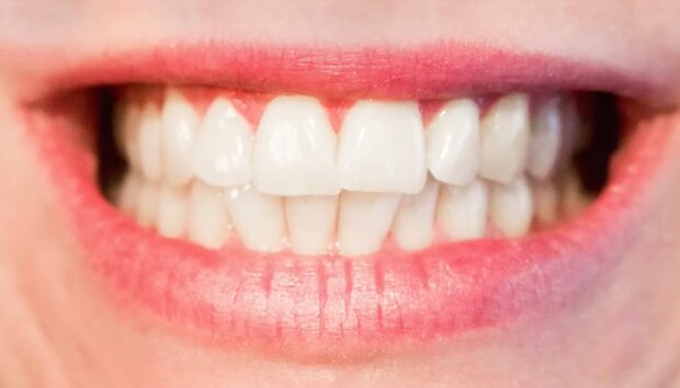 Зубы. Фото: YouTube