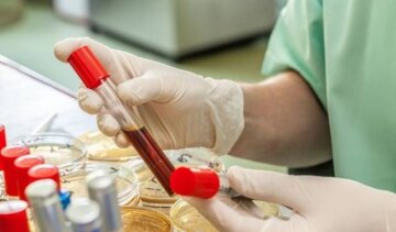 Немало анализов являются бесполезной тратой денег. Фото из открытых источников