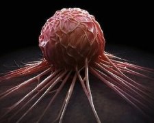 Ученые выяснили, что можно предотвратить смерть от рака