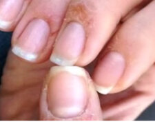 Ногти. Фото: youtube.com
