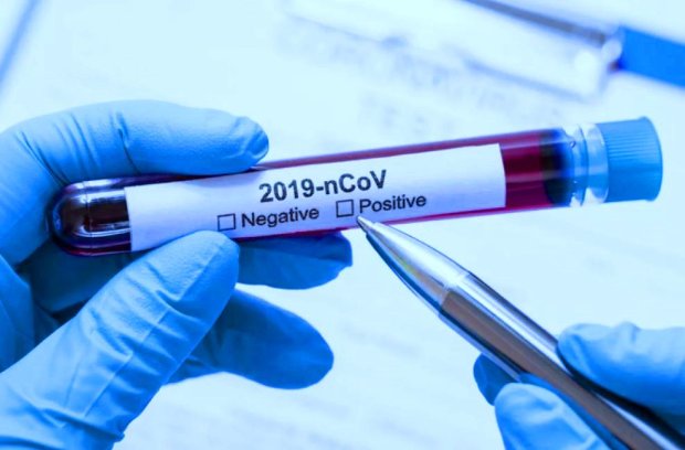 Тест на коронавирус. Фото: Ukranews