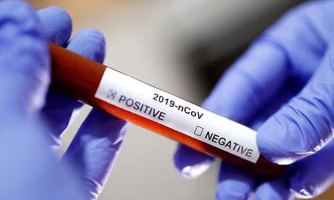 Тест на коронавирус. Фото: pravda.com.ua