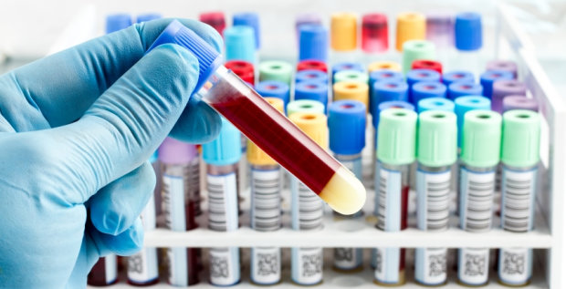 Как правильно расшифровать анализ крови