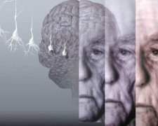 Ученые назвали единственный способ противостоять болезни Альцгеймера