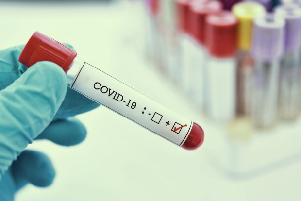 Тест на коронавирус. Фото: Status Quo