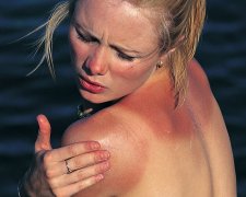 Фотостарение: как ультрафиолет воздействует на кожу, ученые предупреждают о вреде загара