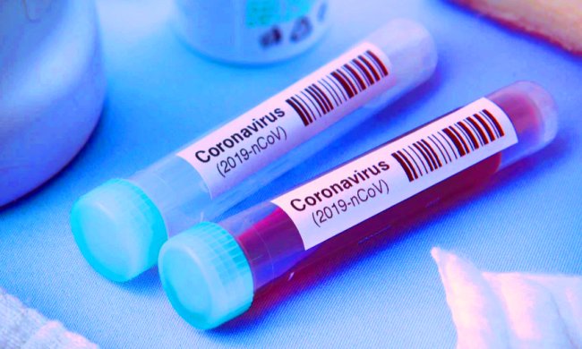 Тест на коронавирус. Фото: Рубрика