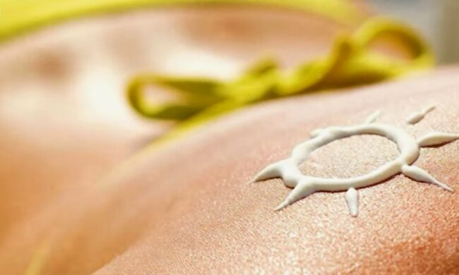 Сонячні опіки. Фото: YouTube