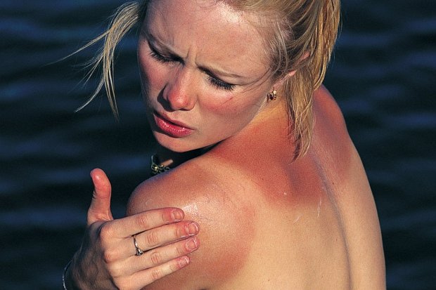 Фотостарение: как ультрафиолет воздействует на кожу, ученые предупреждают о вреде загара