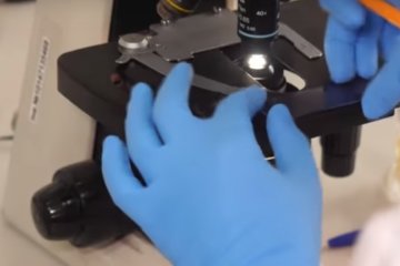 Новый симптом коронавируса. Фото: скриншот YouTube