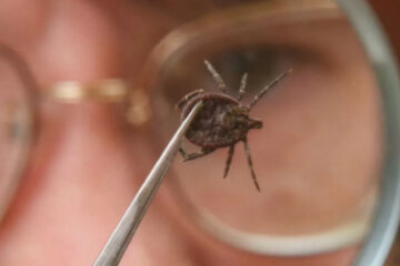 Как уберечь себя и близких от клещей: медики дали важные советы