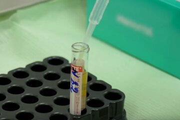 В лаборатории делают шесть анализов крови. Фото: скриншот YouTube-видео