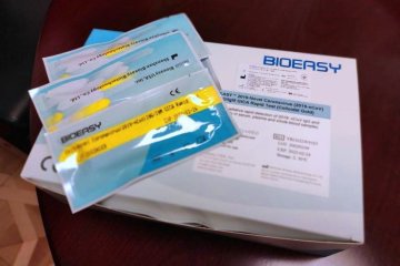 Экспресс-тесты на коронавирус COVID-19. Фото: facebook