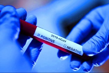 Тест на коронавирус. Фото: 5 канал