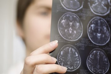 Алкогольную зависимость можно выключить: ученые нашли кнопку