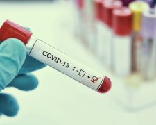 Тест на коронавирус. Фото: Status Quo
