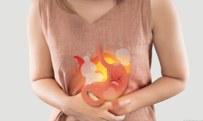 Изжога. Фото: Телеканал "Доктор"