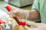 Немало анализов являются бесполезной тратой денег. Фото из открытых источников