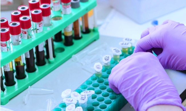 Тестирование на коронавирус. Фото: Новое Время