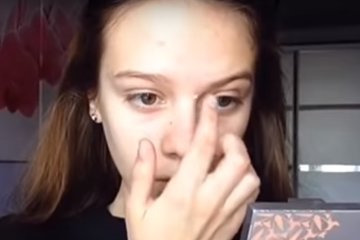 Медики назвали неожиданные причины появления прыщей, скриншот YouTube