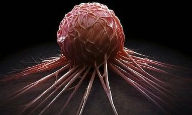 Ученые выяснили, что можно предотвратить смерть от рака