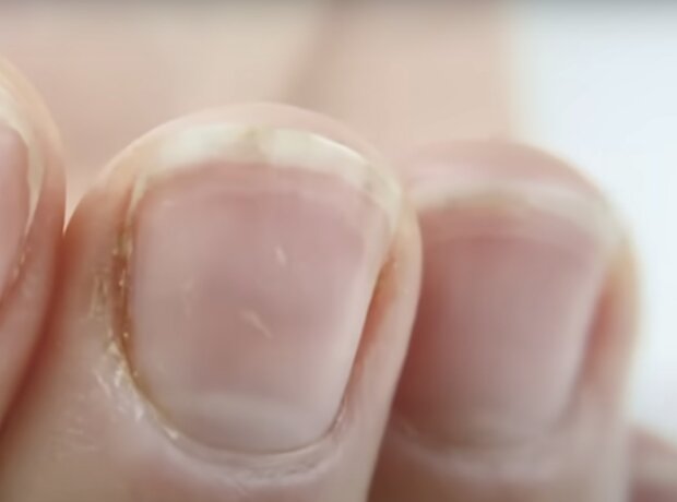 Преображение ногтей: эффективные методы ухода для поддержания их здоровья и красоты