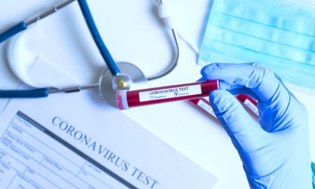 Тест на коронавирус. Фото: Хайтек