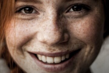 Веснушки, скриншот из YouTube