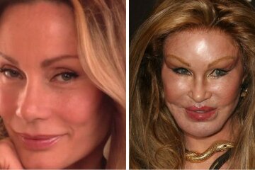 Эксперты дали советы, как выбрать хорошего пластического хирурга