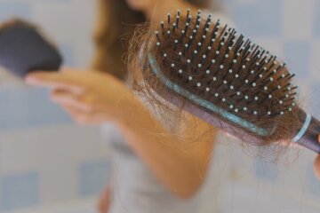 Випадіння волосся. Фото: YouTube