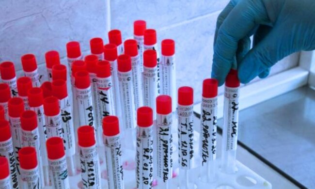 Тест на коронавирус. Фото: Baltnews