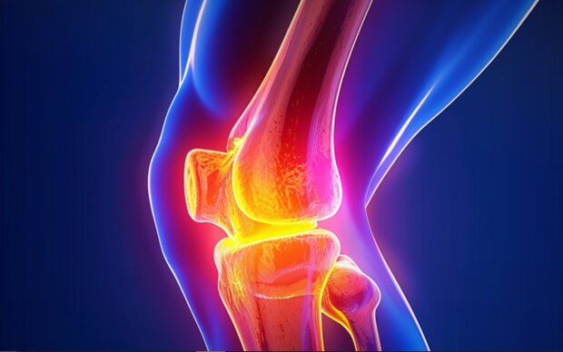 Безкоштовна заміна суглобів: покрокова інструкція від МОЗ як записатися в чергу і не чекати роками