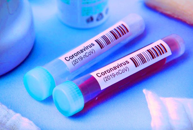 Тест на коронавирус. Фото: Рубрика