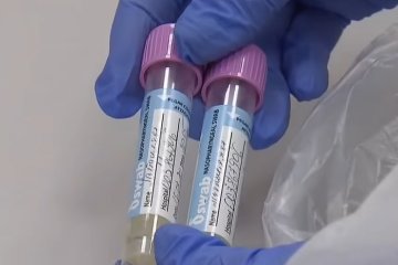 В Минздраве объяснили, почему на Covid-19 тестируют не всех украинцев. Фото: скриншот YouTube