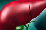 Хотите сохранить печень? Простые способы, за которые она скажет вам "спасибо"