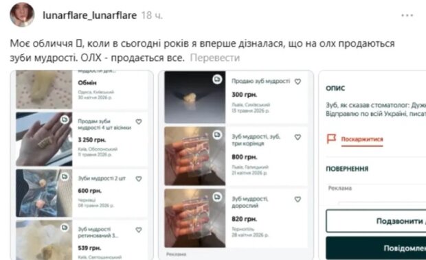 Зуби мудрості на продаж — ілюстративне фото