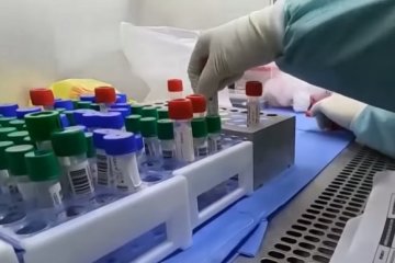 Тест на коронавирус. Фото: скриншот YouTube.