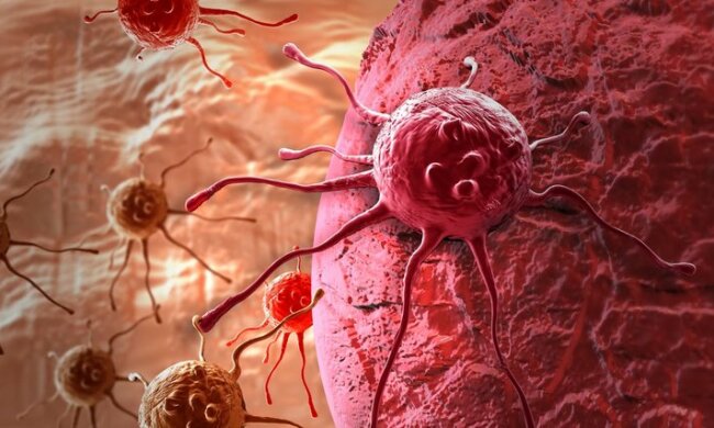 Американские ученые считают, что полностью от рака излечиться невозможно